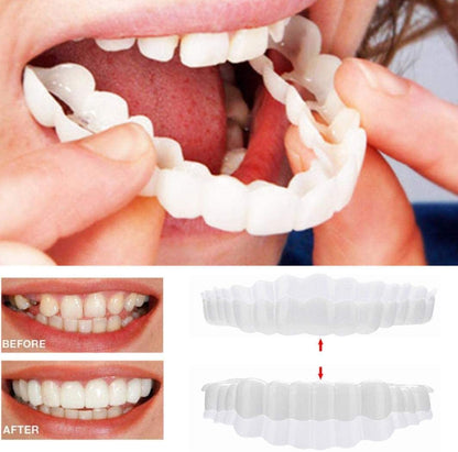 Easy Fit Clip On Teeth Veneers Set Upper Lower
