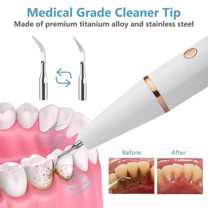 Professional Dental Plaque Remover with LED Light