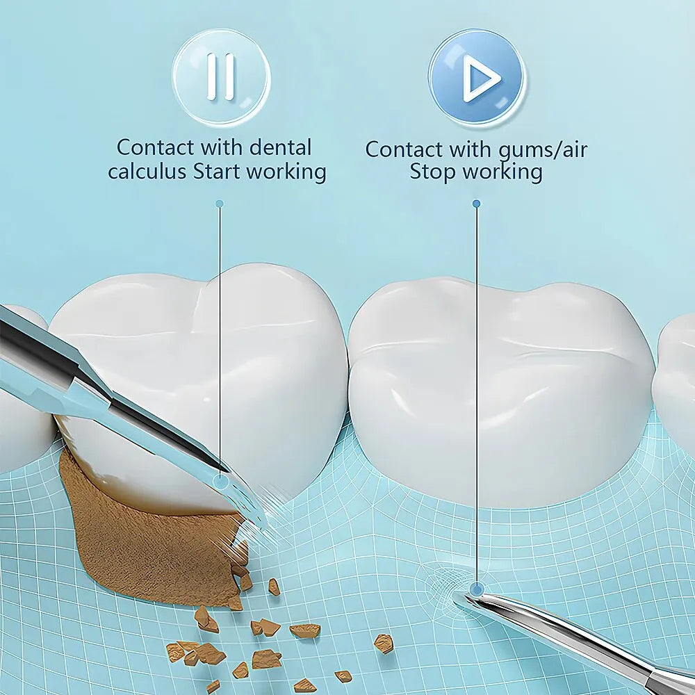 Professional Dental Plaque Remover with LED Light