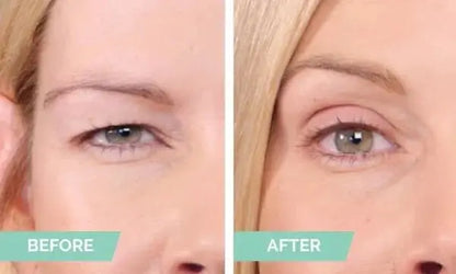 Easy to Use Natural Double Eyelid Tape