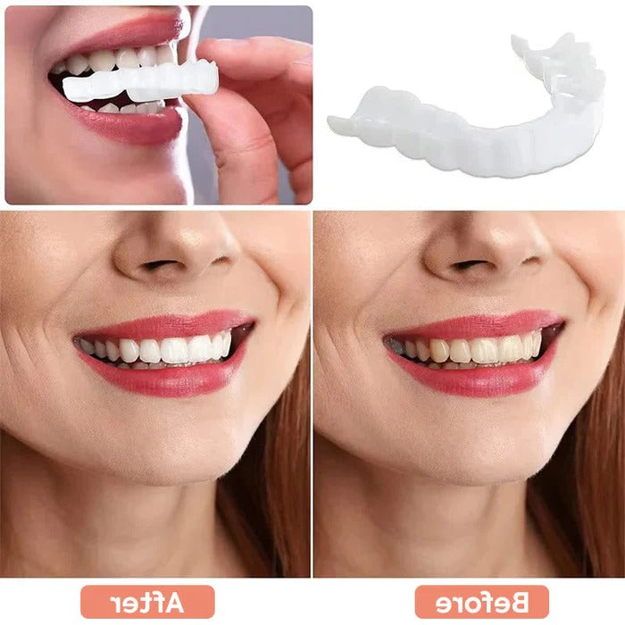 Realistic White Dental Veneers