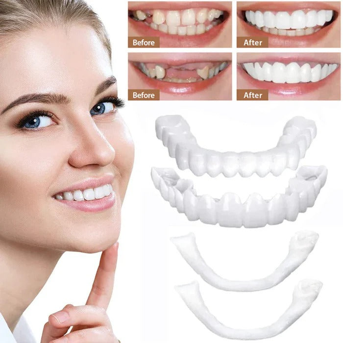 Realistic White Dental Veneers