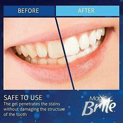 Complete Teeth Whitening Kit At Home With LED Light Included - Until Times Up